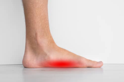 The Impact of Bunions on Your Overall Foot Health
