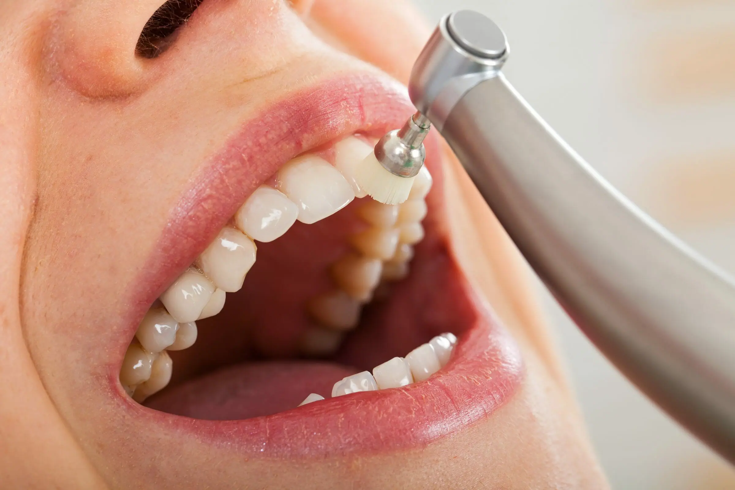 Dental Crowns: Your Guide to Restoring Damaged Teeth with Confidence