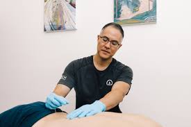 Exploring the Role of Acupuncture in Managing Autoimmune Conditions