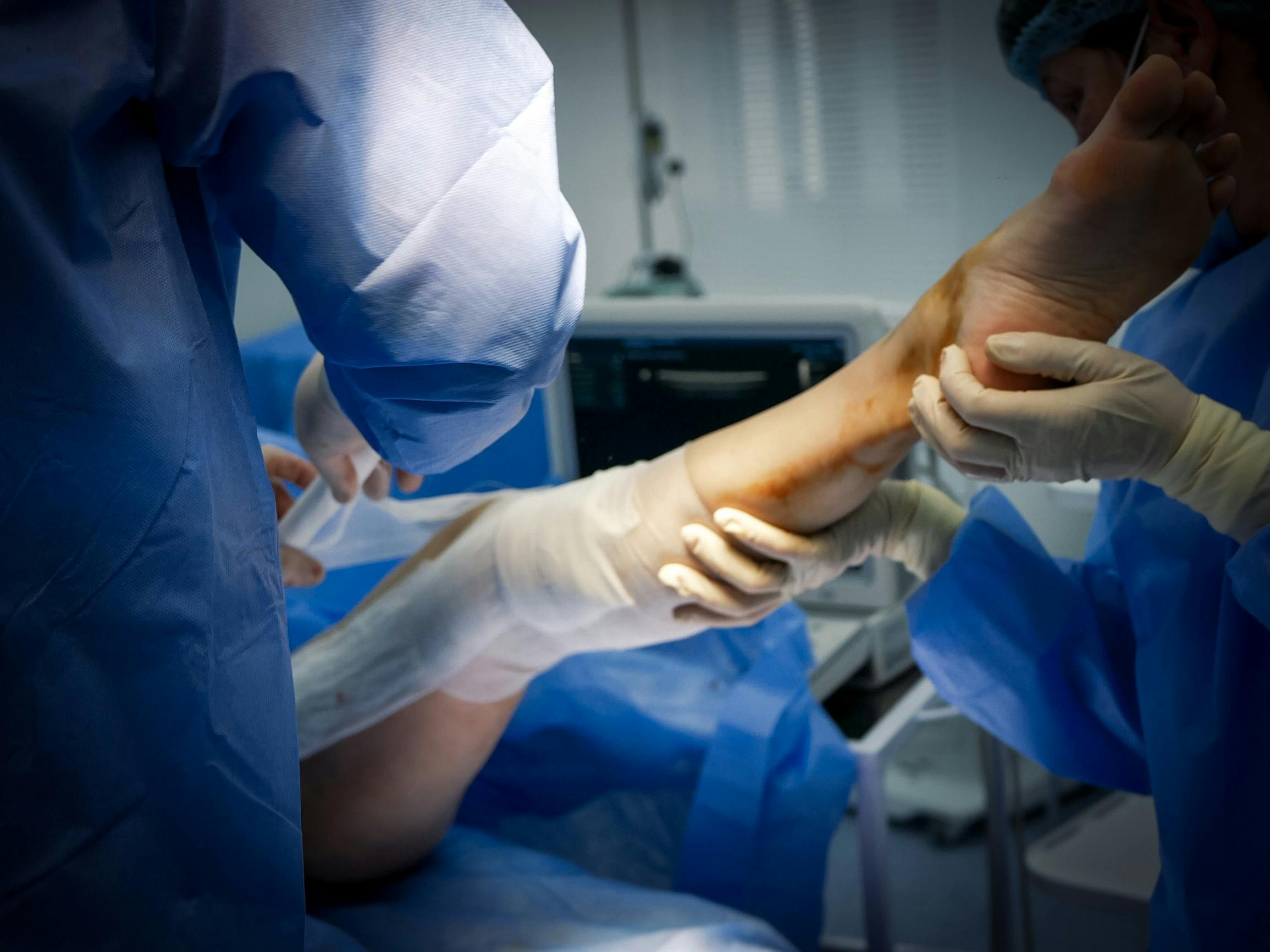 How Do Wound Care Centers Treat Chronic Leg Wounds?