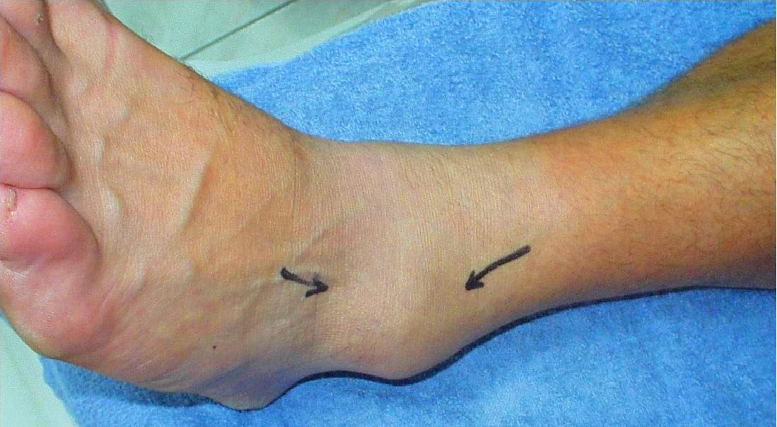How Foot Doctors Treat Common Foot and Ankle Issues