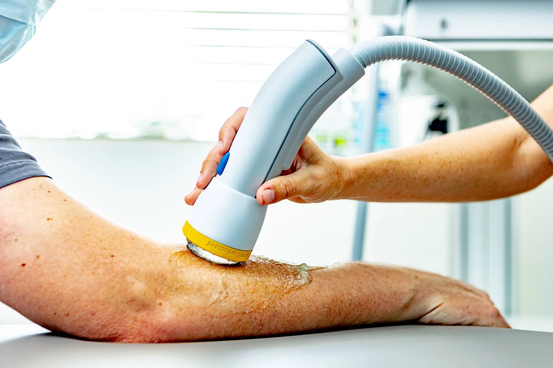 The Latest Innovations in Vein Care and Treatment Options