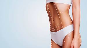 The Role of Diet and Exercise After Liposuction