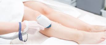 Tips for Laser Hair Removal Aftercare