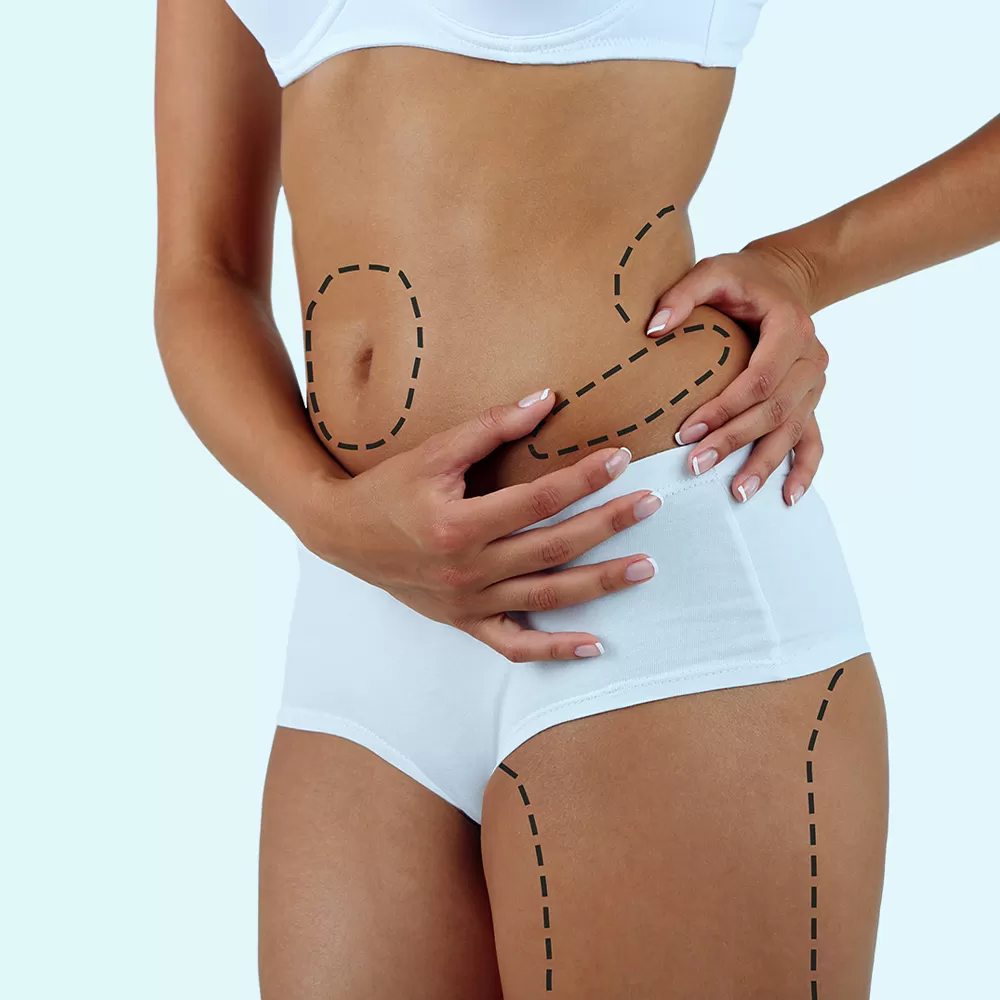 Tummy Tuck Results: What to Expect During Recovery