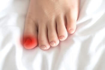 Understanding Ingrown Toenails: Causes, Treatments, and the Role of Stress and Trauma